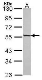 Anti-ICA1 antibody [N1N3] used in Western Blot (WB). GTX114483