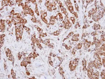 Anti-IDH3A antibody used in IHC (Paraffin sections) (IHC-P). GTX114486