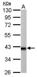 Anti-IDH3A antibody used in Western Blot (WB). GTX114486