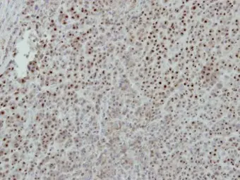 Anti-ISG20 antibody used in IHC (Paraffin sections) (IHC-P). GTX114499
