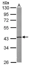Anti-IVD antibody used in Western Blot (WB). GTX114502