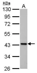 Anti-IVD antibody used in Western Blot (WB). GTX114502