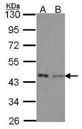 Anti-IVD antibody used in Western Blot (WB). GTX114502