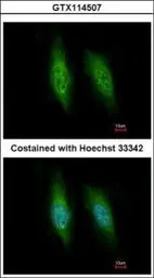 Anti-KIFC3 antibody used in Immunocytochemistry/ Immunofluorescence (ICC/IF). GTX114507