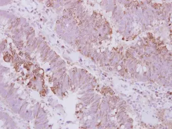 Anti-KIFC3 antibody used in IHC (Paraffin sections) (IHC-P). GTX114507