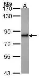 Anti-KIFC3 antibody used in Western Blot (WB). GTX114507