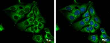 Anti-Lactate Dehydrogenase C antibody used in Immunocytochemistry/ Immunofluorescence (ICC/IF). GTX114525