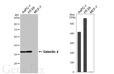 Anti-Galectin 4 antibody used in Western Blot (WB). GTX114527