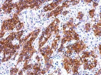 Anti-Galectin 4 antibody used in IHC (Paraffin sections) (IHC-P). GTX114527