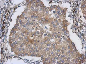 Anti-LMAN1 antibody [N1C1] used in IHC (Paraffin sections) (IHC-P). GTX114530