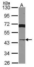 Anti-VWA5A antibody used in Western Blot (WB). GTX114531