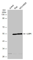 Anti-LSP1 antibody [N2C3] used in Western Blot (WB). GTX114533