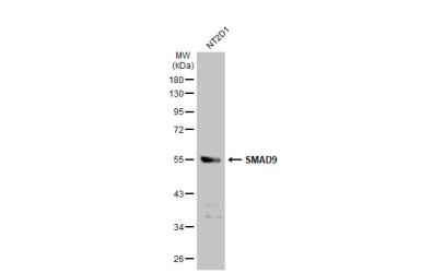 Anti-SMAD9 antibody used in Western Blot (WB). GTX114540