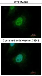 Anti-SMAD9 antibody used in Immunocytochemistry/ Immunofluorescence (ICC/IF). GTX114540