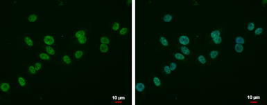 Anti-MLLT6 antibody used in Immunocytochemistry/ Immunofluorescence (ICC/IF). GTX114552