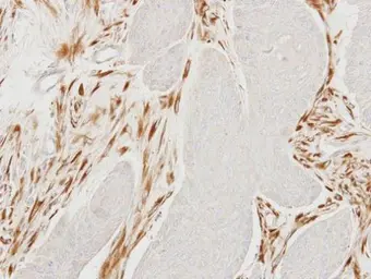 Anti-MOCS2 antibody [N1C3] used in IHC (Paraffin sections) (IHC-P). GTX114554