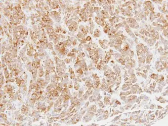 Anti-MPI antibody used in IHC (Paraffin sections) (IHC-P). GTX114555