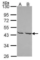 Anti-MPI antibody used in Western Blot (WB). GTX114555