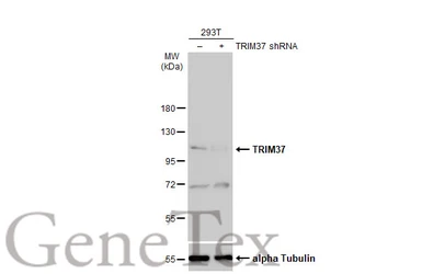 Anti-TRIM37 antibody [N1N2], N-term used in Western Blot (WB). GTX114565