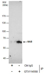 Anti-NAB2 antibody [N3C2], Internal used in Immunoprecipitation (IP). GTX114568