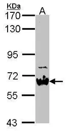Anti-NAB2 antibody [N3C2], Internal used in Western Blot (WB). GTX114568