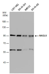 Anti-NAGLU antibody [N3C1], Internal used in Western Blot (WB). GTX114569