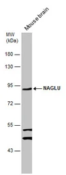 Anti-NAGLU antibody [N3C1], Internal used in Western Blot (WB). GTX114569