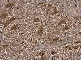 Anti-NAGLU antibody [N3C1], Internal used in IHC (Paraffin sections) (IHC-P). GTX114569