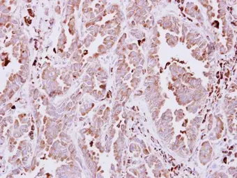 Anti-NAGLU antibody [N3C1], Internal used in IHC (Paraffin sections) (IHC-P). GTX114569
