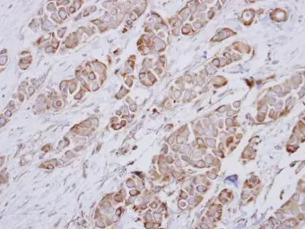 Anti-NDUFA10 antibody used in IHC (Paraffin sections) (IHC-P). GTX114572