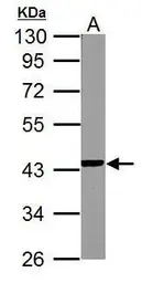 Anti-NDUFA10 antibody used in Western Blot (WB). GTX114572