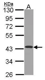 Anti-NDUFA10 antibody used in Western Blot (WB). GTX114572