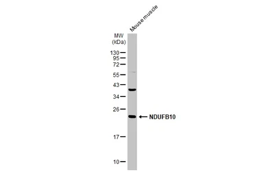 Anti-NDUFB10 antibody [N1C3] used in Western Blot (WB). GTX114576