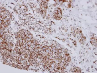 Anti-NDUFB10 antibody [N1C3] used in IHC (Paraffin sections) (IHC-P). GTX114576