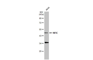 Anti-NFIC antibody used in Western Blot (WB). GTX114583