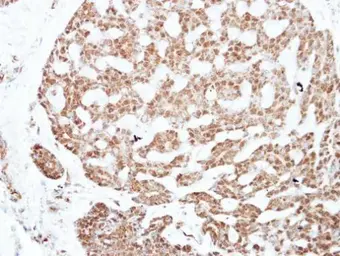 Anti-NFIC antibody used in IHC (Paraffin sections) (IHC-P). GTX114583