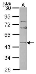 Anti-NP2 antibody [N3C3] used in Western Blot (WB). GTX114590