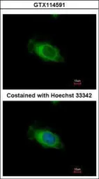 Anti-Nardilysin antibody [N3C2], Internal used in Immunocytochemistry/ Immunofluorescence (ICC/IF). GTX114591
