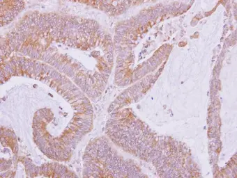 Anti-Nardilysin antibody [N3C2], Internal used in IHC (Paraffin sections) (IHC-P). GTX114591
