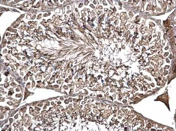Anti-ODF2 antibody used in IHC (Paraffin sections) (IHC-P). GTX114594