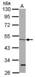 Anti-ORC4L antibody [C1C3] used in Western Blot (WB). GTX114601