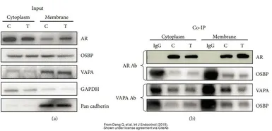 Anti-OSBP antibody [N2C1], Internal used in Western Blot (WB). GTX114602