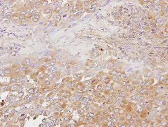 Anti-OSBP antibody [N2C1], Internal used in IHC (Paraffin sections) (IHC-P). GTX114602