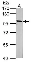 Anti-OSBP antibody [N2C1], Internal used in Western Blot (WB). GTX114602