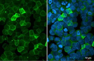 Anti-P2Y2 antibody [N3C3] used in Immunocytochemistry/ Immunofluorescence (ICC/IF). GTX114609