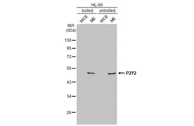 Anti-P2Y2 antibody [N3C3] used in Western Blot (WB). GTX114609