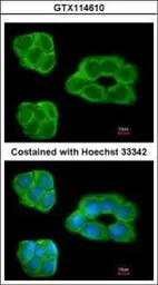 Anti-EBP1 antibody [N3C3] used in Immunocytochemistry/ Immunofluorescence (ICC/IF). GTX114610