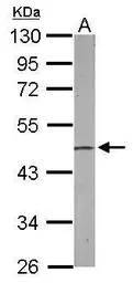 Anti-EBP1 antibody [N3C3] used in Western Blot (WB). GTX114610