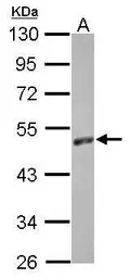Anti-EBP1 antibody [N3C3] used in Western Blot (WB). GTX114610