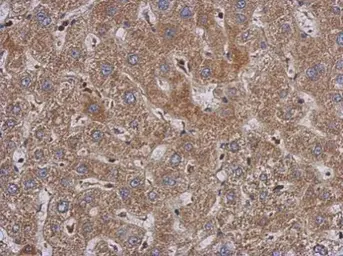 Anti-PABPC3 antibody used in IHC (Paraffin sections) (IHC-P). GTX114611